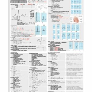 ECG Cheat Sheet Cardiologist Poster Canvas 1