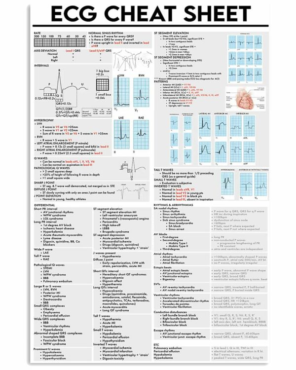 ECG Cheat Sheet Cardiologist Poster, Canvas