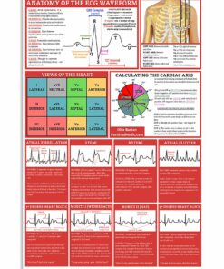 Anatomy Of The ECG Waveform Cardiologist Poster Canvas 1