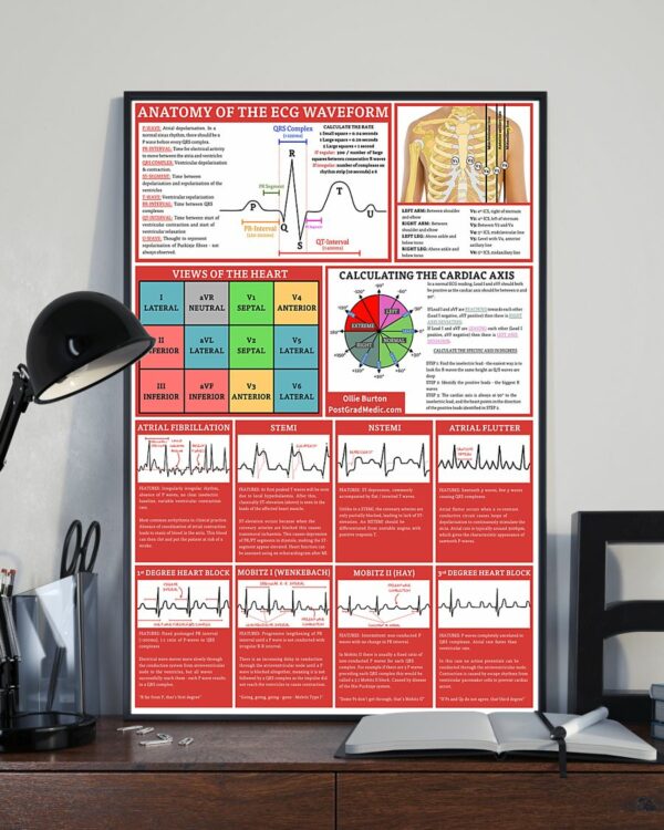 Anatomy Of The ECG Waveform Cardiologist Poster, Canvas