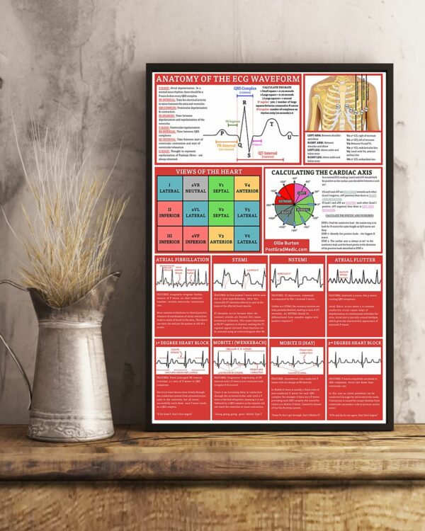 Anatomy Of The ECG Waveform Cardiologist Poster, Canvas